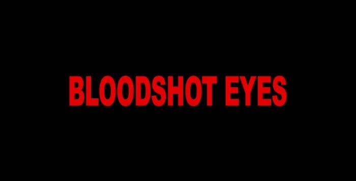 bloodshot eyes